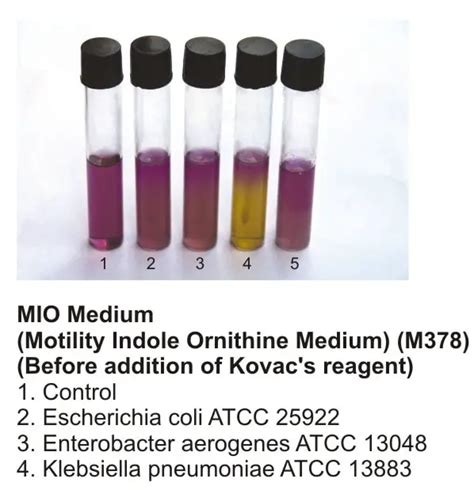 motility indole ornithine|e coli motility test results.